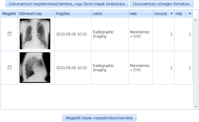 38. ábra Dicom képek listája